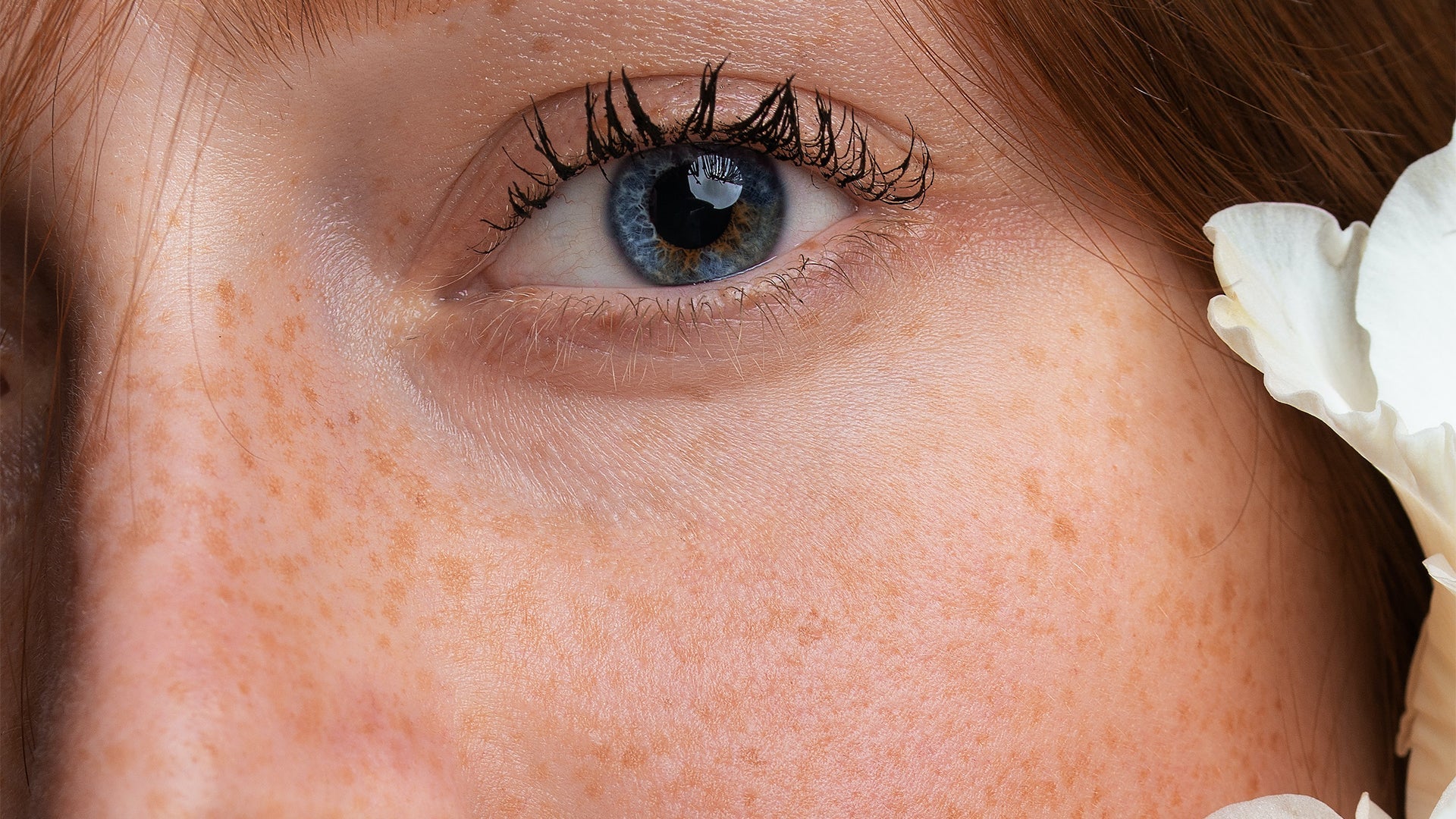 Which Vitamins and Minerals Support Healthy Eyes and Vision?