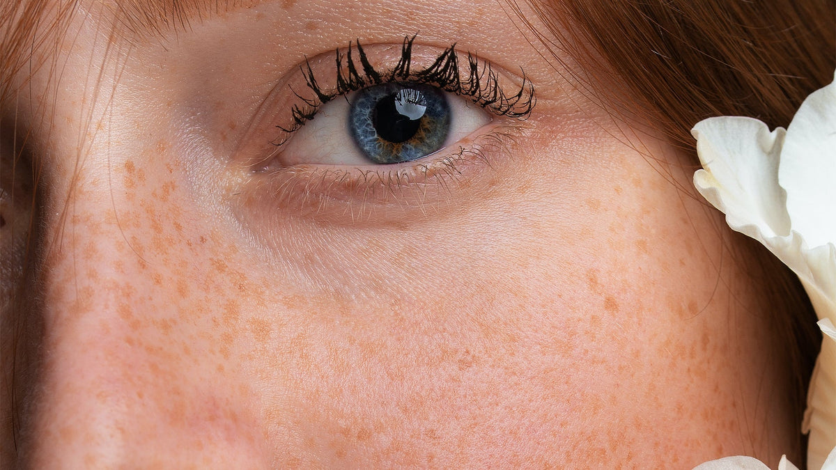 Which Vitamins and Minerals Support Healthy Eyes and Vision?